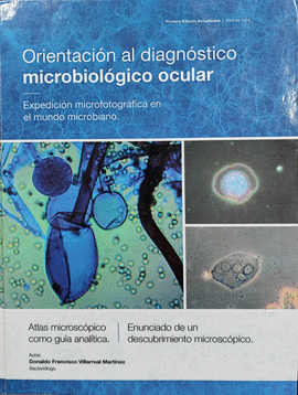 ORIENTACION AL DIAGNOSTICO MICROBIOLOGICO OCULAR