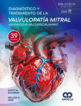 DIAGNÓSTICO Y TRATAMIENTO DE LA VALVULOPATÍA MITRAL