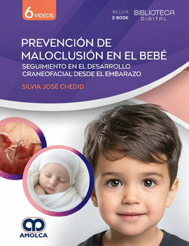 PREVENCIÓN DE MALOCLUSIÓN EN EL BEBÉ