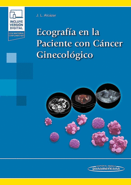 ECOGRAFÍA EN LA PACIENTE CON CÁNCER GINECOLÓGICO