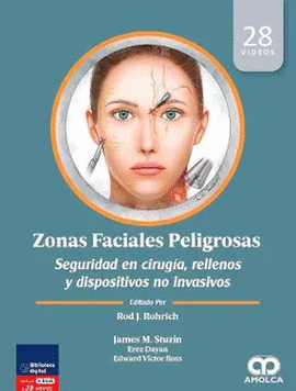 ZONAS FACIALES PELIGROSAS. SEGURIDAD EN CIRUGIA, RELLENOS