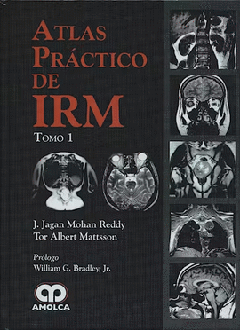 ATLAS PRACTICO DE IRM (TOMO I Y II)