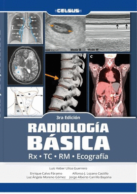 RADIOLOGÍA BÁSICA