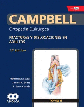 CAMPBELL VOL 6-FRACTURAS Y DISLOCACIONES